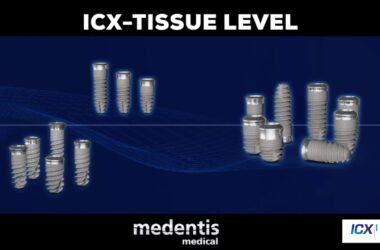 Silo-Implant-System-presenta-gli-impianti-ICX