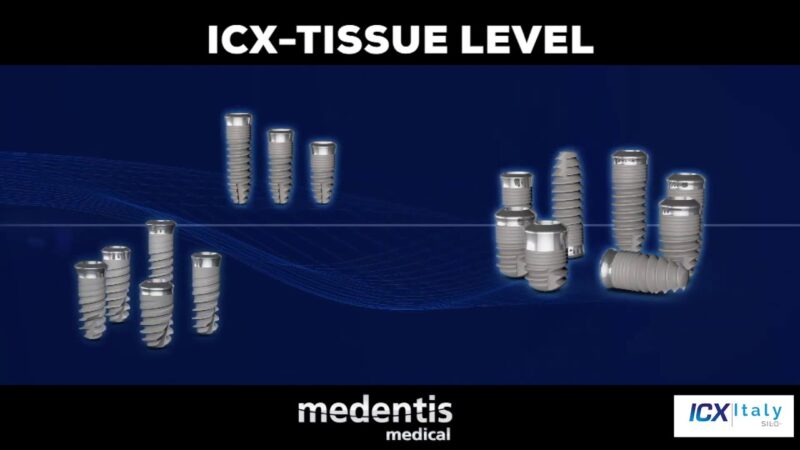 Silo-Implant-System-presenta-gli-impianti-ICX